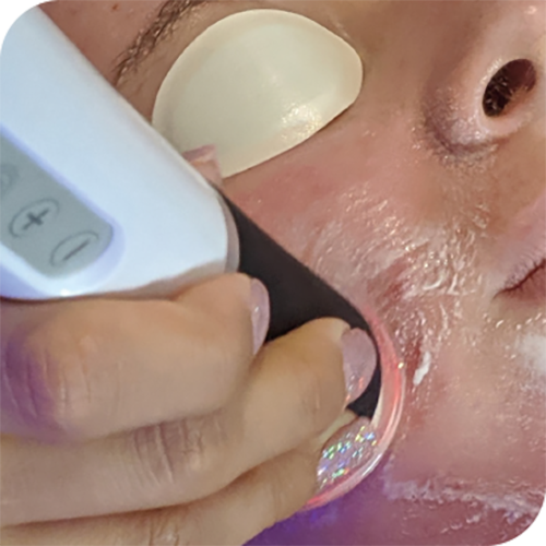 3D Aesthetics Hydr02 Facial