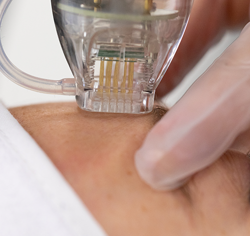 3D Aesthetics DermaForce