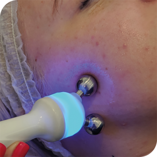 3D Aesthetics Hydr02 Facial