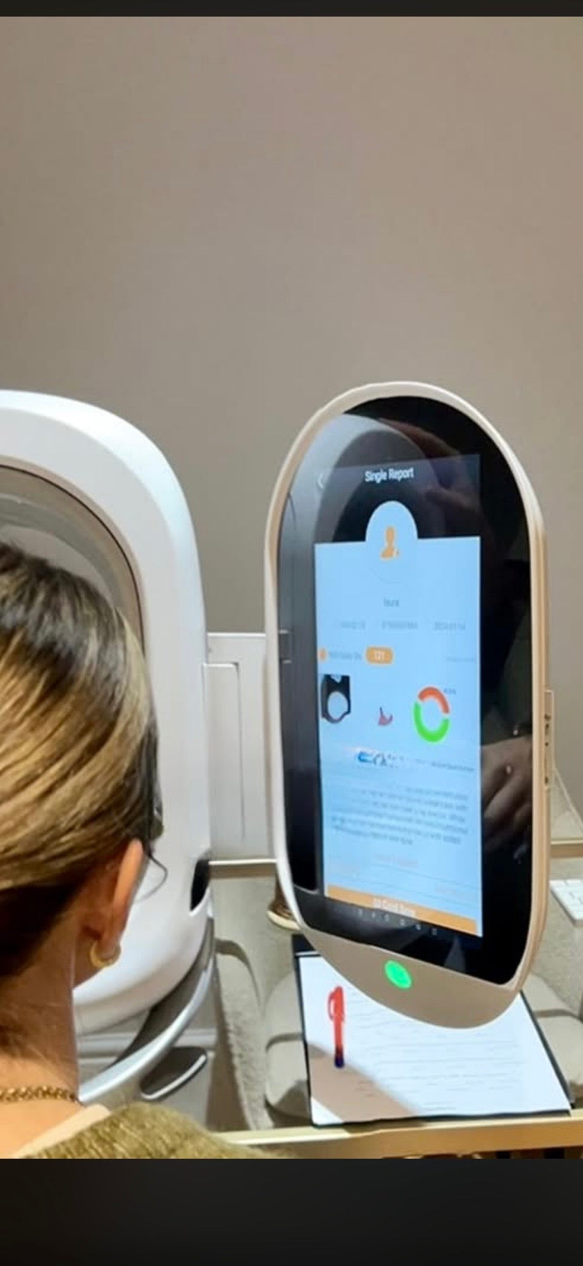 Opatra skin analyser dome