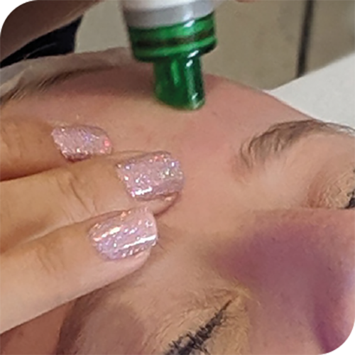 3D Aesthetics Hydr02 Facial