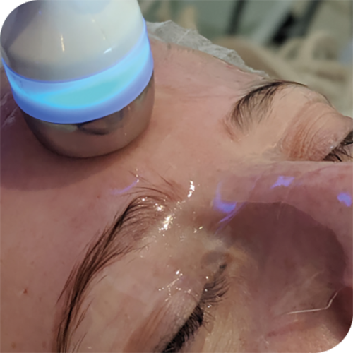 3D Aesthetics Hydr02 Facial